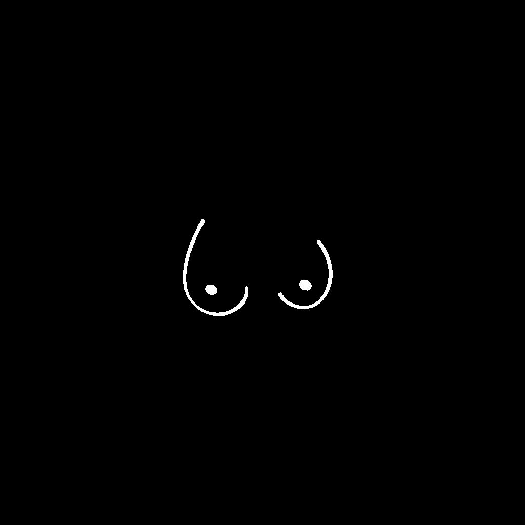 Asymmetrical breast shape